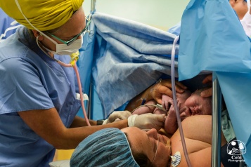 C-section hospital birth.
